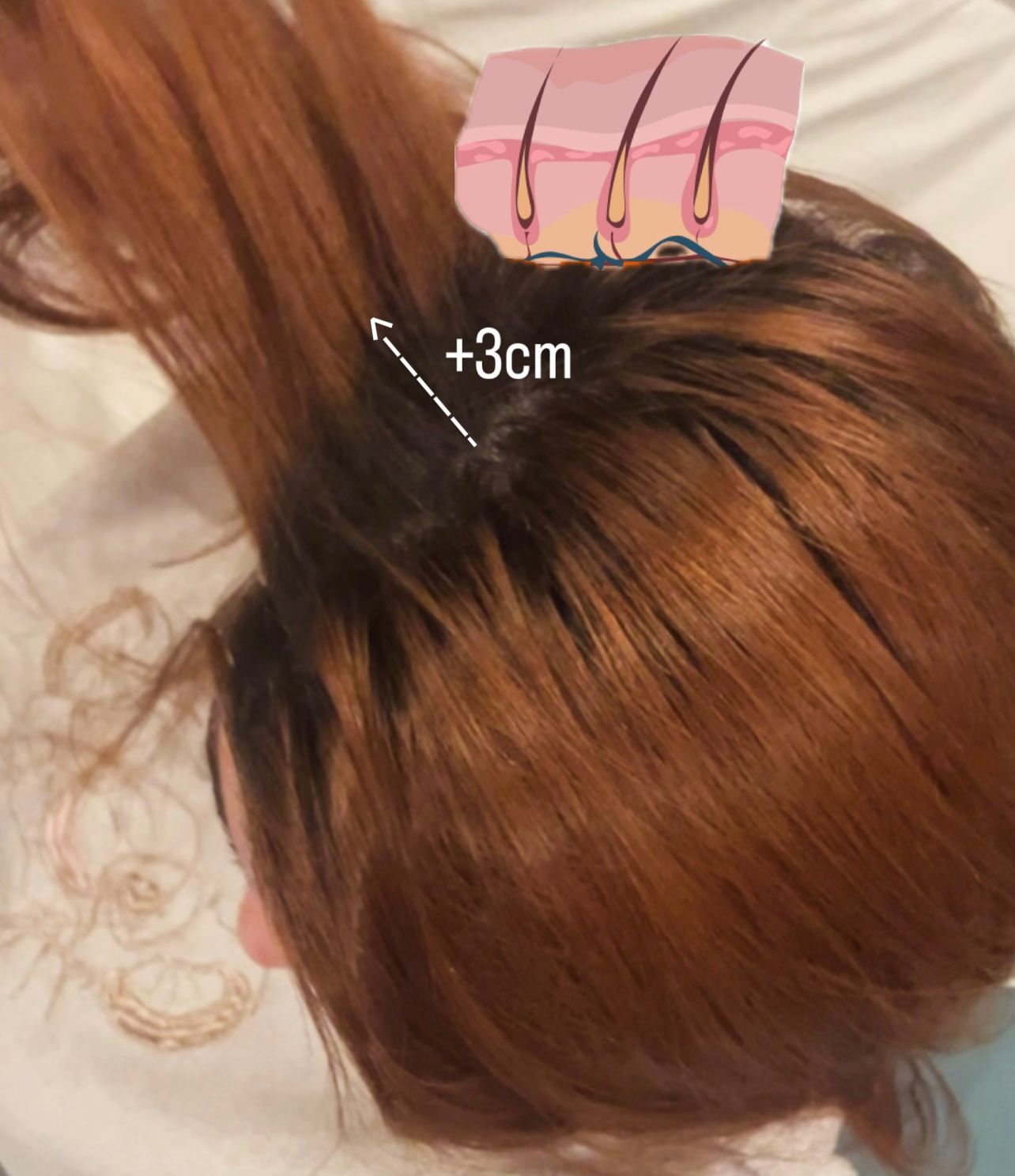 Set Crecimiento Capilar