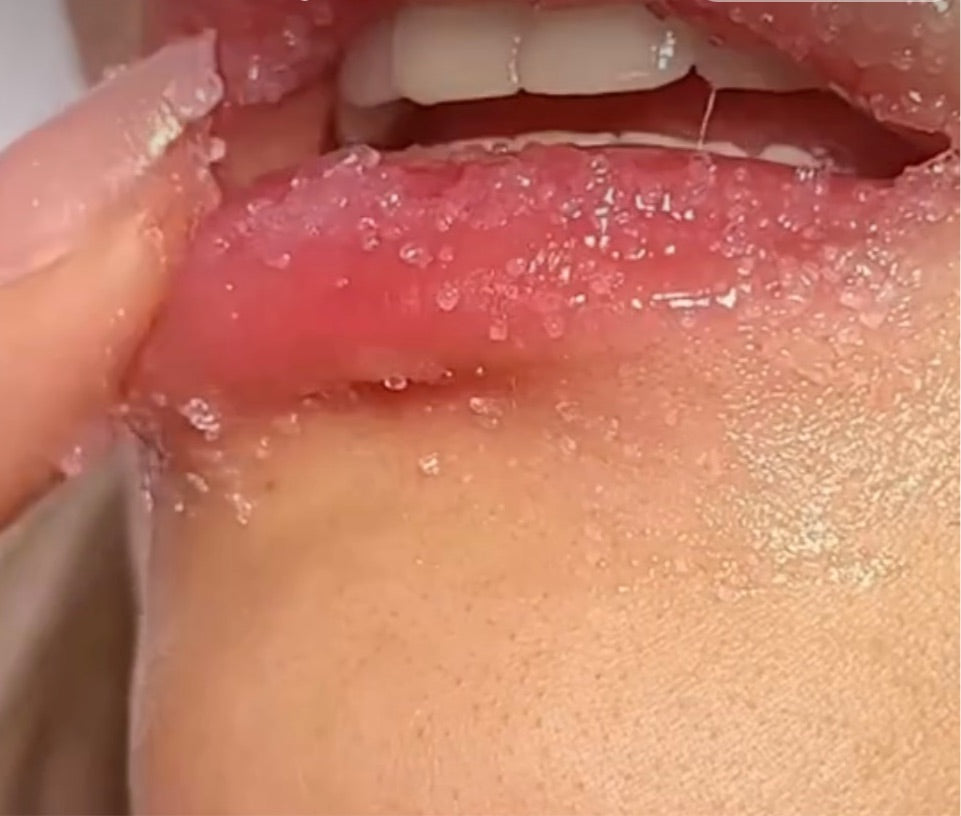 Exfoliante de labios