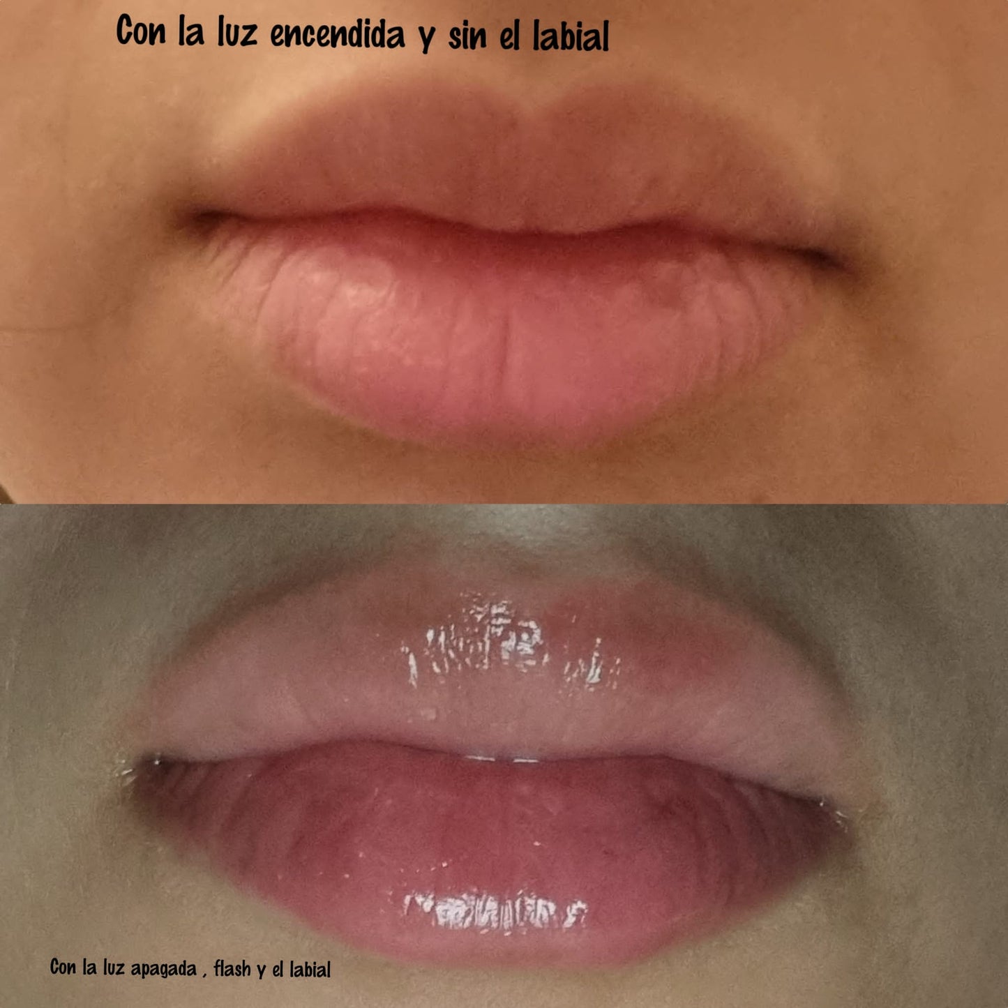 Voluminizador de labios